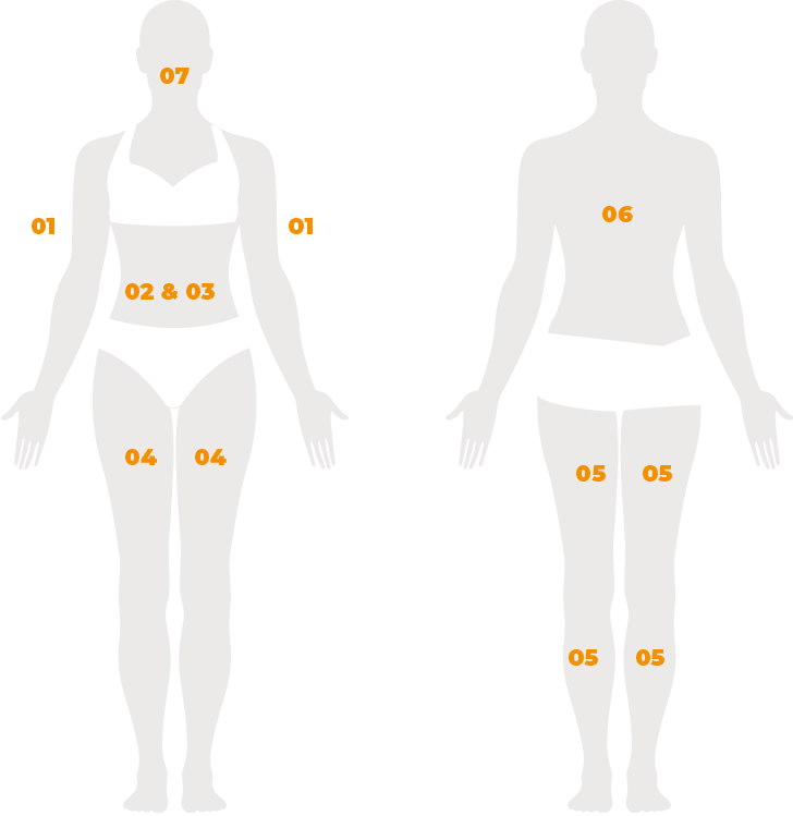 NARL zones de traitements